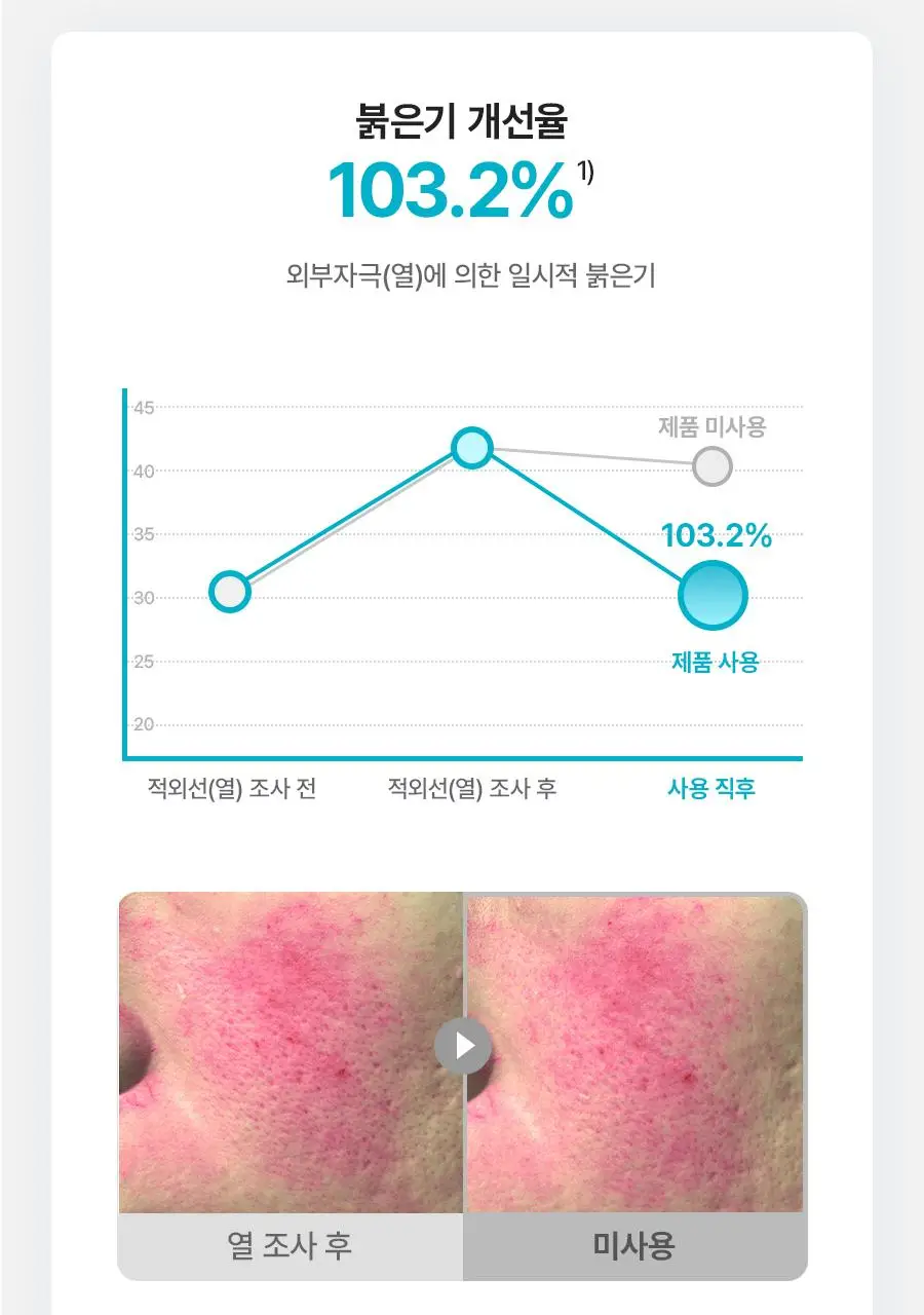 [NEW/리뷰이벤트] 비욘드 엔젤 아쿠아 이온 히알루10% 수분 진정 크림 100ml 1+1 기획 상세페이지 29